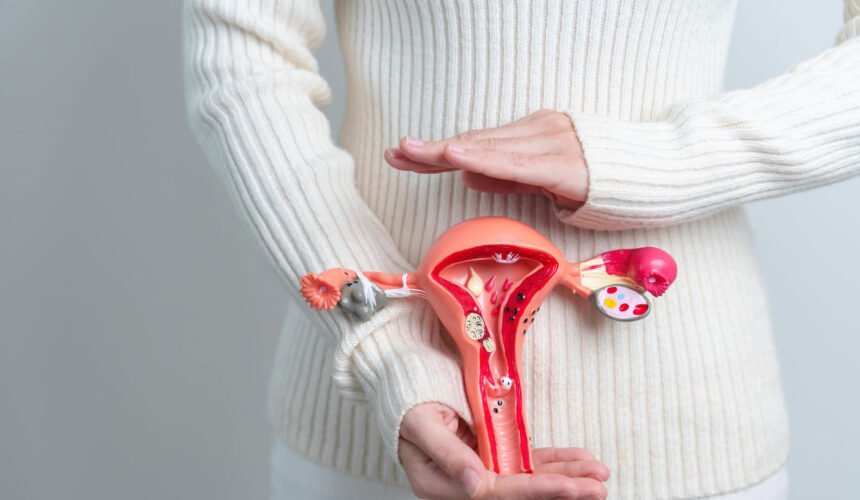 Uterine Fibroids 1 2