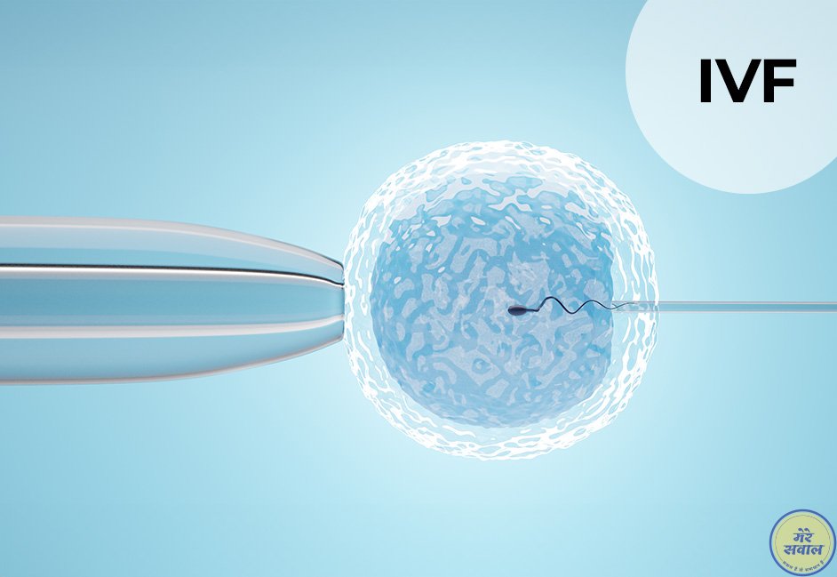 IVF