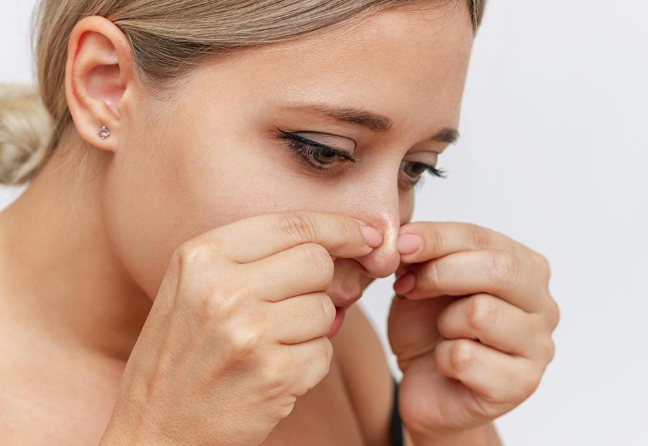 ब्लैकहेड्स क्या है? ब्लैकहेड्स हटाने के 12 घरेलू फेस स्क्रब्स 15 Fevicol