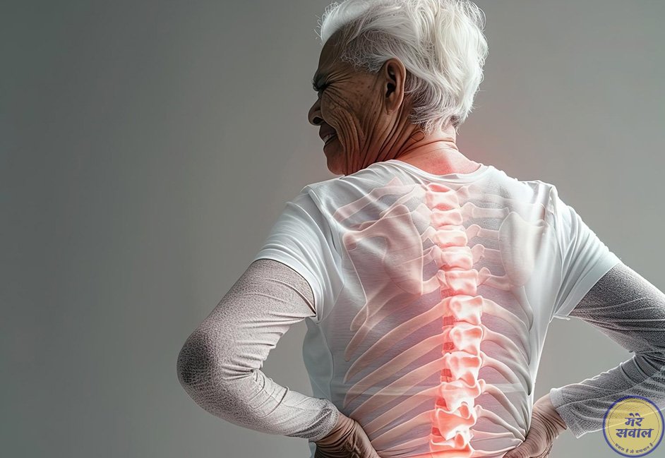 Osteoporosis